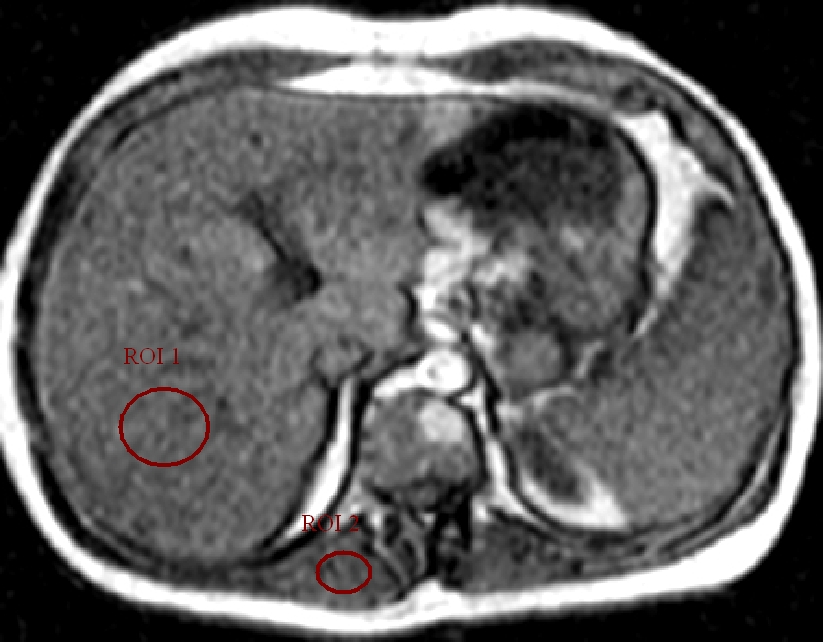 Regions Of Interest ROI